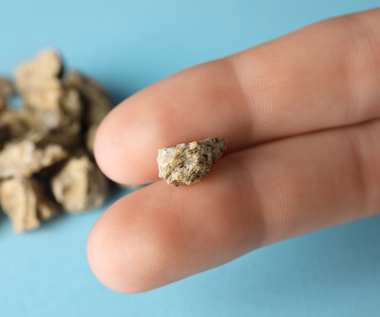 l carnitine kidney stones The case for a ketogenic diet in the management of kidney disease
