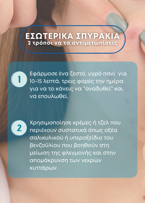 σπυρακια