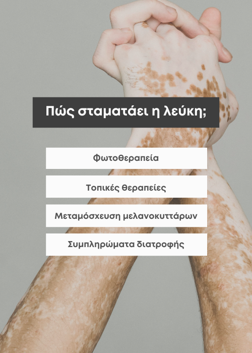 λευκη