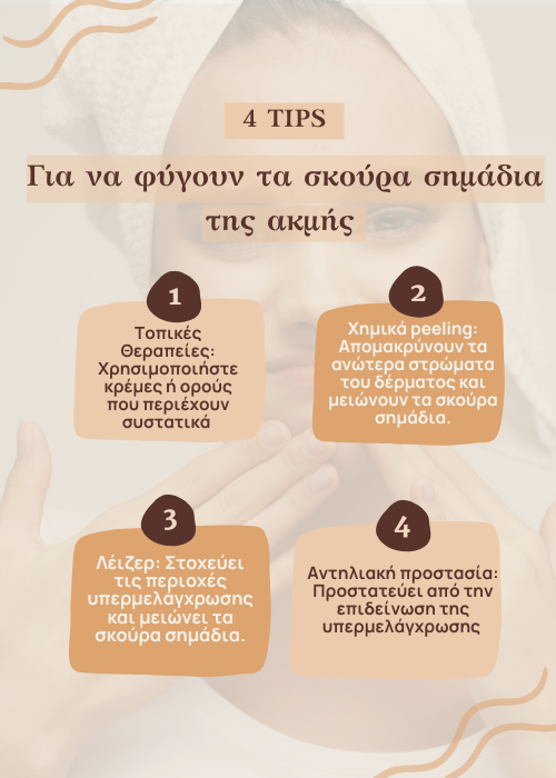σημαδια ακμης