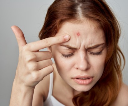 Σπυράκια στο πρόσωπο: Τι τα προκαλεί;