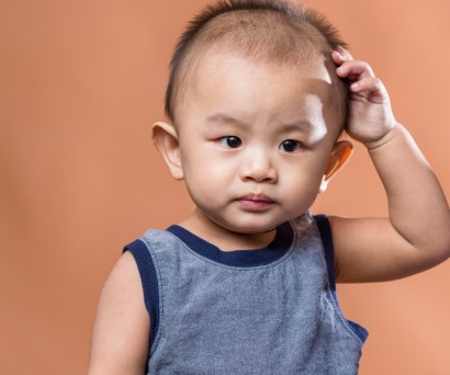 Γιατί το μωρό μου ξύνει το κεφάλι του;