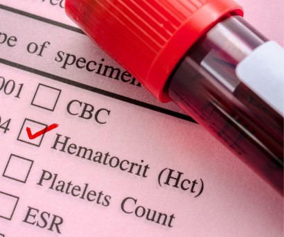 Οι τροφές που ανεβάζουν τον αιματοκρίτη