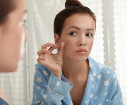 Pimple patches: ο καλύτερος φίλος σου για να κρύψεις τα σπυράκια σου