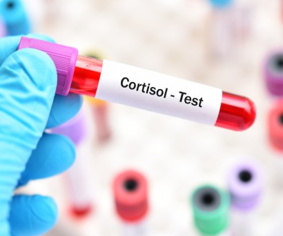 Αυξημένη κορτιζόλη: Συμπτώματα και αντιμετώπιση