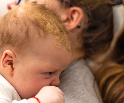 Νινίδα μωρού: Τι είναι και πώς φεύγει