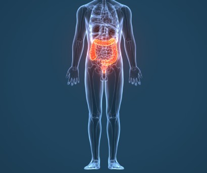 Φλεγμονή παχέος εντέρου: Συμπτώματα και αντιμετώπιση