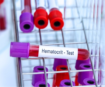 Χαμηλός αιματοκρίτης: Όλα όσα πρέπει να γνωρίζεις