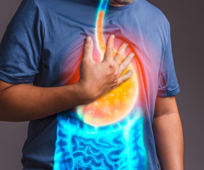 Καούρα στο στομάχι: Αιτίες και λύσεις